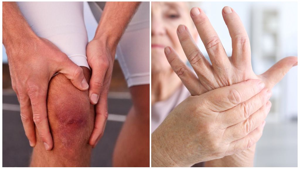 Болят суставы пальцев рук к какому врачу. Ревматоидный артрит полиартрит. Ревматоид артрит симптомы.